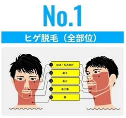 メンズリゼ 脱毛人気NO.1